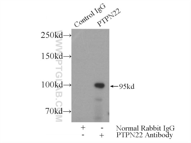 PTPN22 Antibody in Immunoprecipitation (IP)