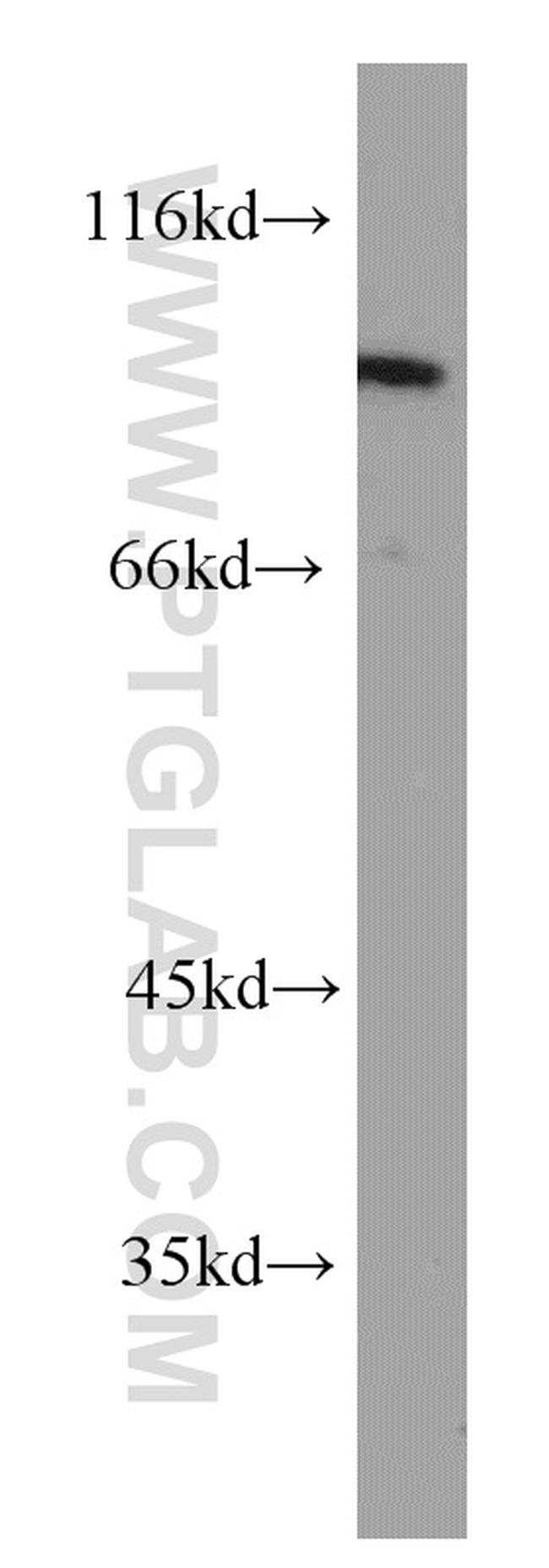 PTPN22 Antibody in Western Blot (WB)