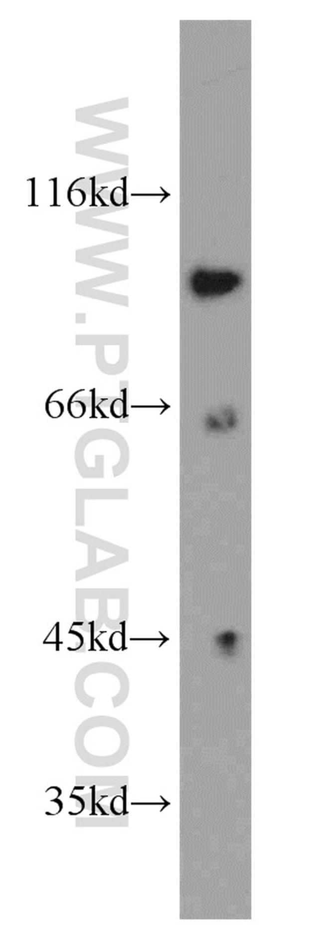 PTPN22 Antibody in Western Blot (WB)