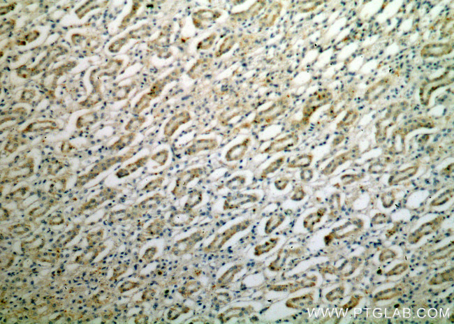 LY96/MD2 Antibody in Immunohistochemistry (Paraffin) (IHC (P))