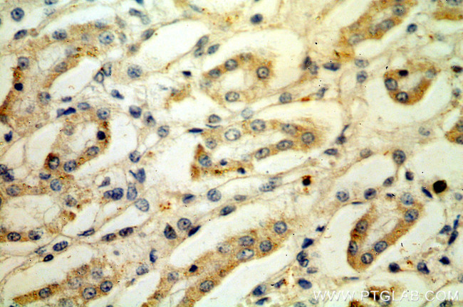 LY96/MD2 Antibody in Immunohistochemistry (Paraffin) (IHC (P))