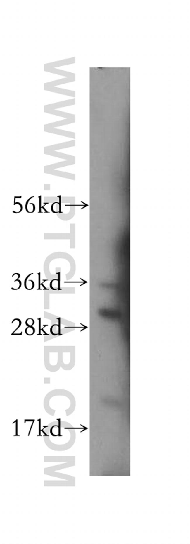 LY96/MD2 Antibody in Western Blot (WB)