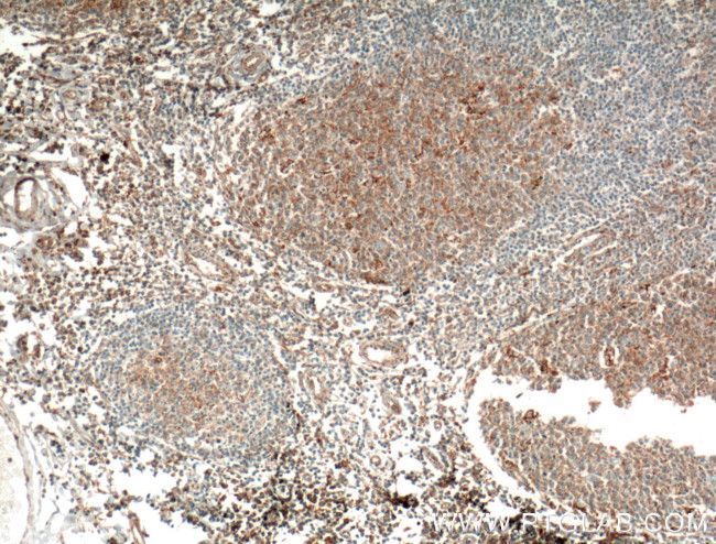 Eotaxin Antibody in Immunohistochemistry (Paraffin) (IHC (P))