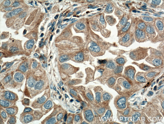 Eotaxin Antibody in Immunohistochemistry (Paraffin) (IHC (P))