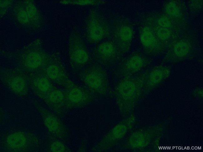 PRIM2 Antibody in Immunocytochemistry (ICC/IF)