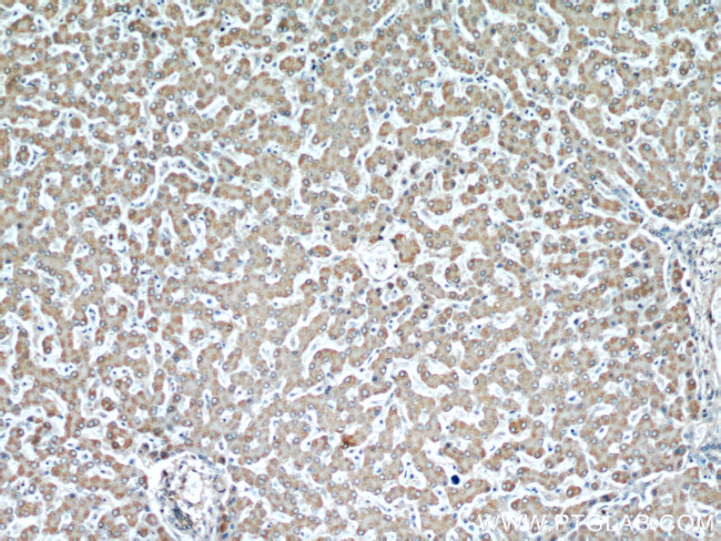 DIO1 Antibody in Immunohistochemistry (Paraffin) (IHC (P))