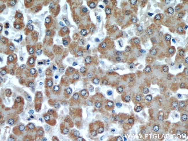 DIO1 Antibody in Immunohistochemistry (Paraffin) (IHC (P))