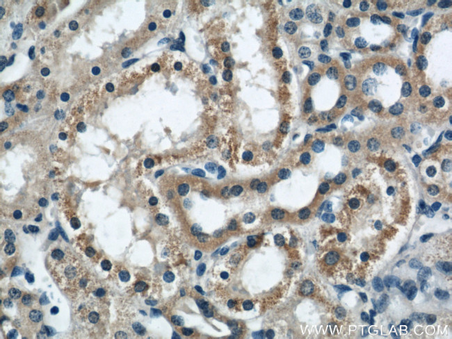 DIO1 Antibody in Immunohistochemistry (Paraffin) (IHC (P))