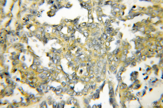 DIO1 Antibody in Immunohistochemistry (Paraffin) (IHC (P))