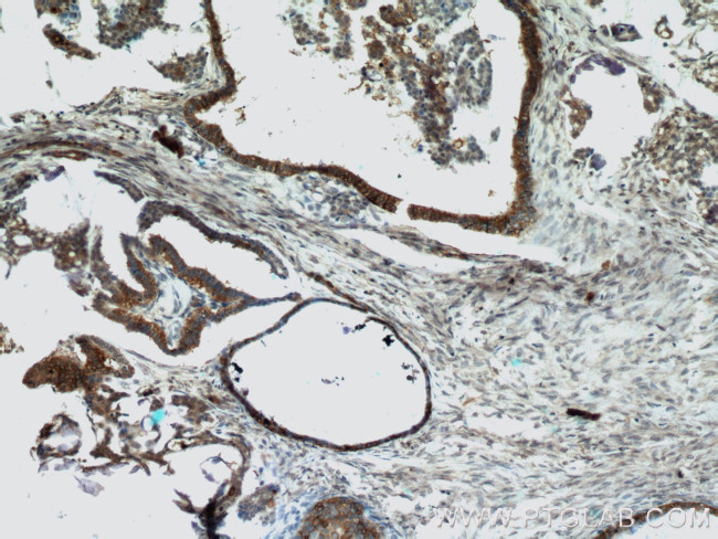 DIO1 Antibody in Immunohistochemistry (Paraffin) (IHC (P))