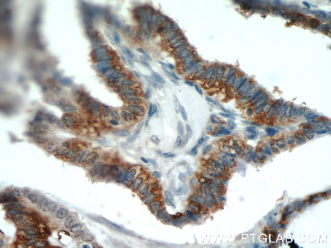 DIO1 Antibody in Immunohistochemistry (Paraffin) (IHC (P))