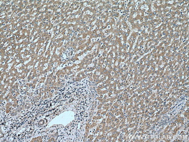 DIO1 Antibody in Immunohistochemistry (Paraffin) (IHC (P))