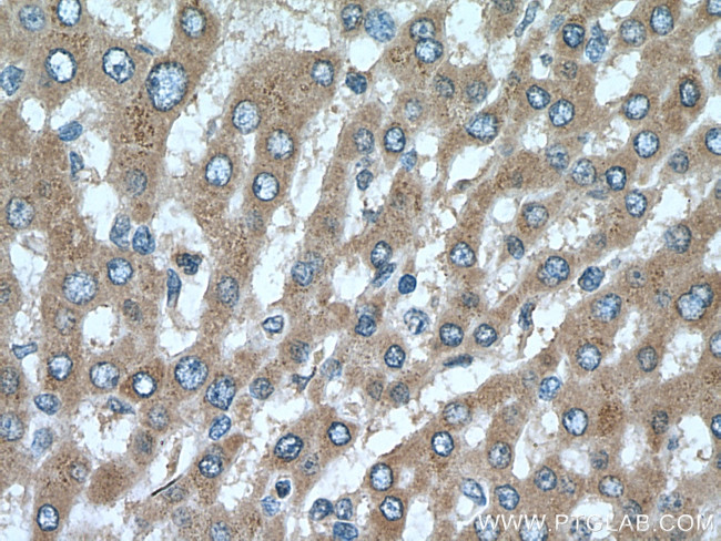 DIO1 Antibody in Immunohistochemistry (Paraffin) (IHC (P))