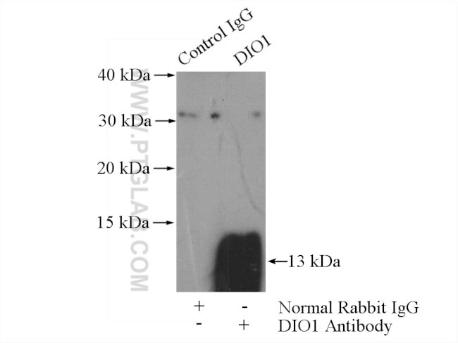 DIO1 Antibody in Immunoprecipitation (IP)