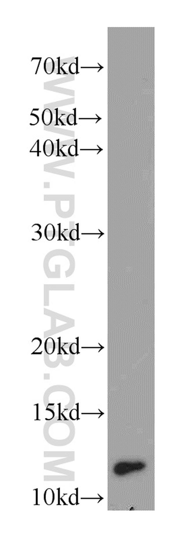 DIO1 Antibody in Western Blot (WB)