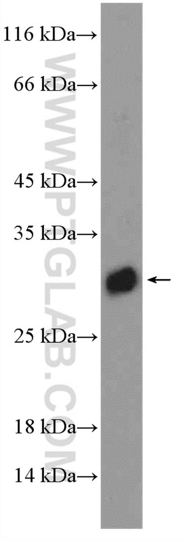 DIO1 Antibody in Western Blot (WB)