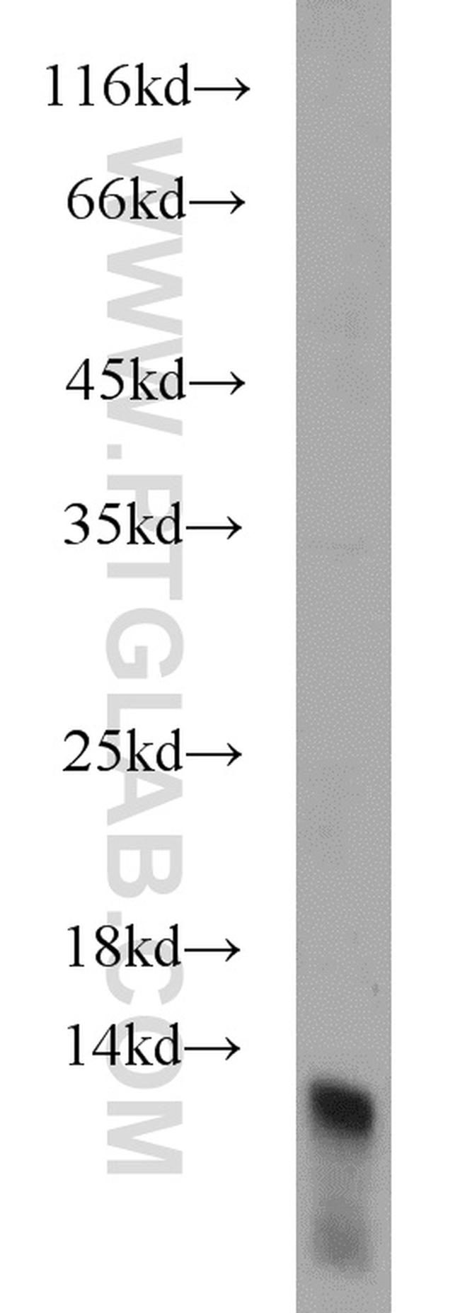 DIO1 Antibody in Western Blot (WB)