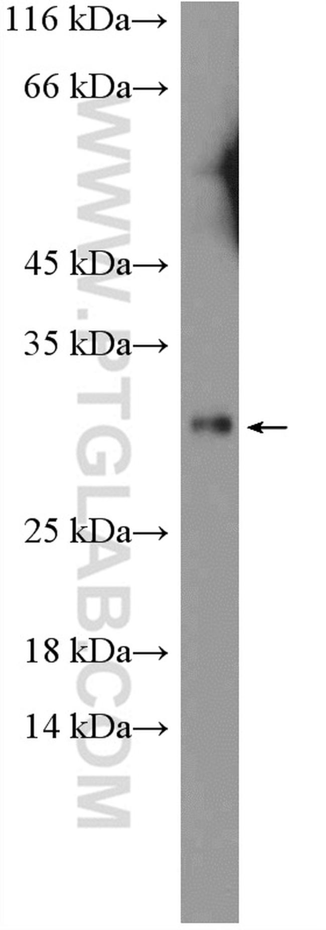 DIO1 Antibody in Western Blot (WB)