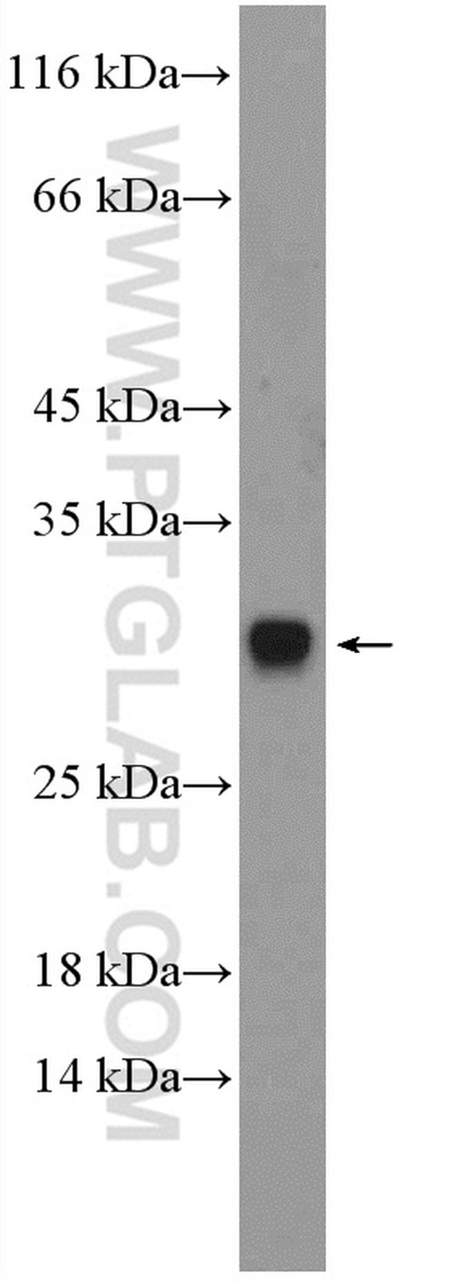 DIO1 Antibody in Western Blot (WB)