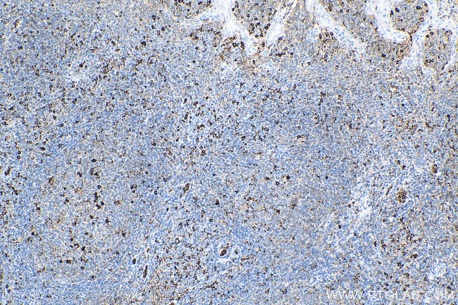 TREM1 Antibody in Immunohistochemistry (Paraffin) (IHC (P))