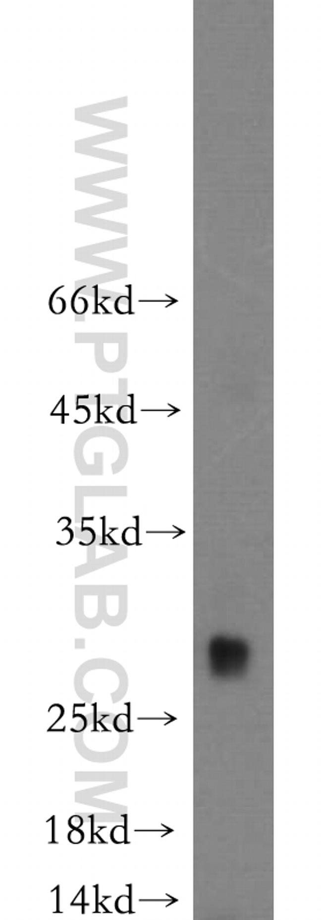 TREM1 Antibody in Western Blot (WB)