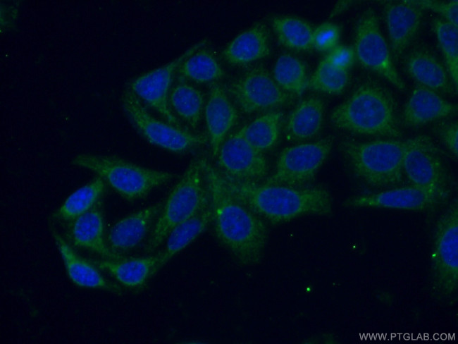 RAB8B Antibody in Immunocytochemistry (ICC/IF)