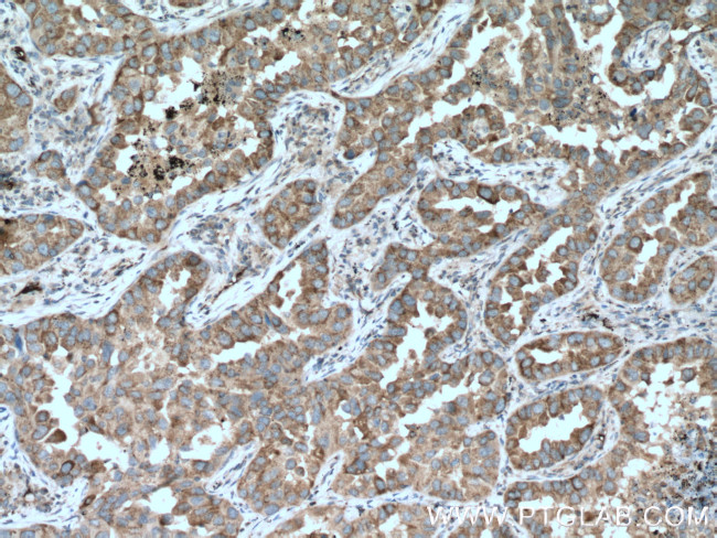 RAB8B Antibody in Immunohistochemistry (Paraffin) (IHC (P))