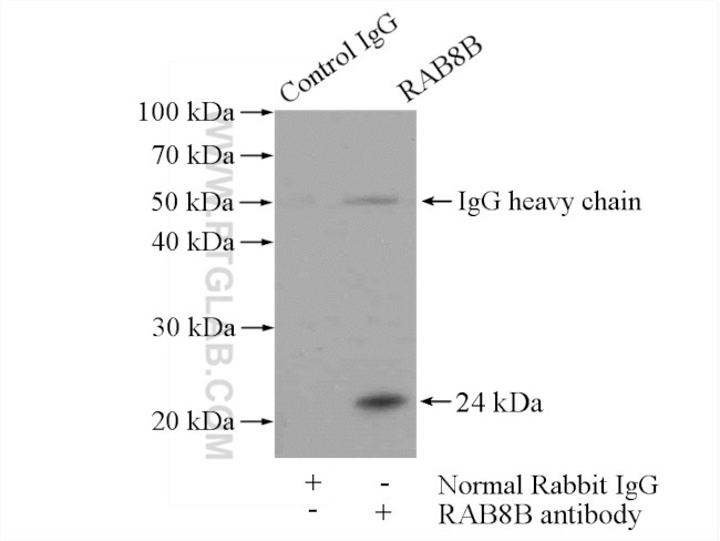 RAB8B Antibody in Immunoprecipitation (IP)