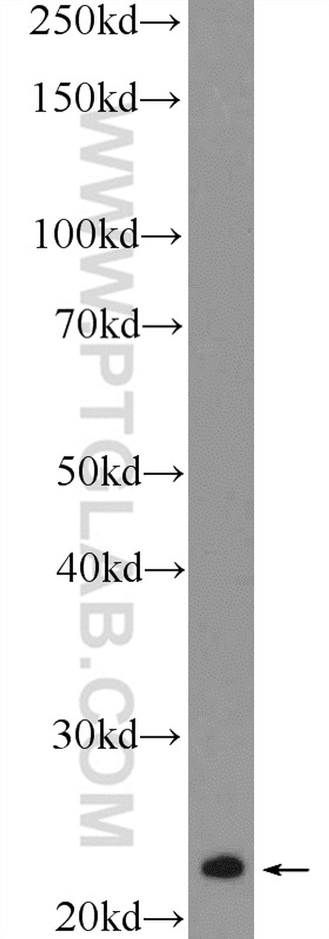 RAB8B Antibody in Western Blot (WB)