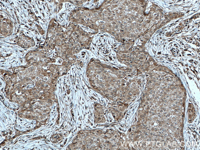 KYNU Antibody in Immunohistochemistry (Paraffin) (IHC (P))