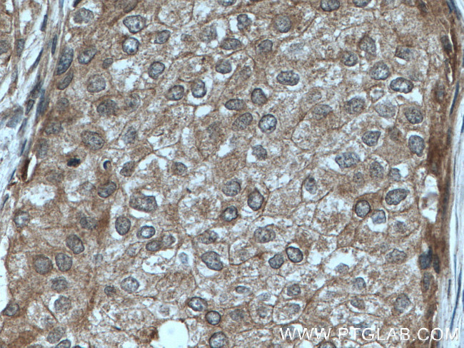 KYNU Antibody in Immunohistochemistry (Paraffin) (IHC (P))