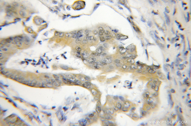 NA14 Antibody in Immunohistochemistry (Paraffin) (IHC (P))