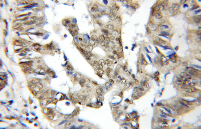 BUD31 Antibody in Immunohistochemistry (Paraffin) (IHC (P))