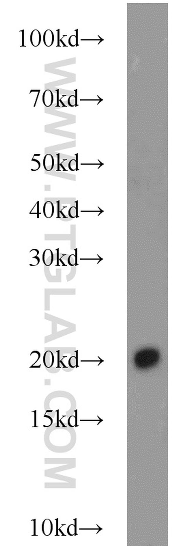 BUD31 Antibody in Western Blot (WB)