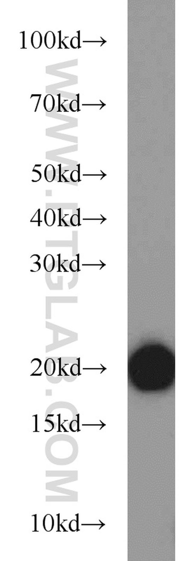 BUD31 Antibody in Western Blot (WB)