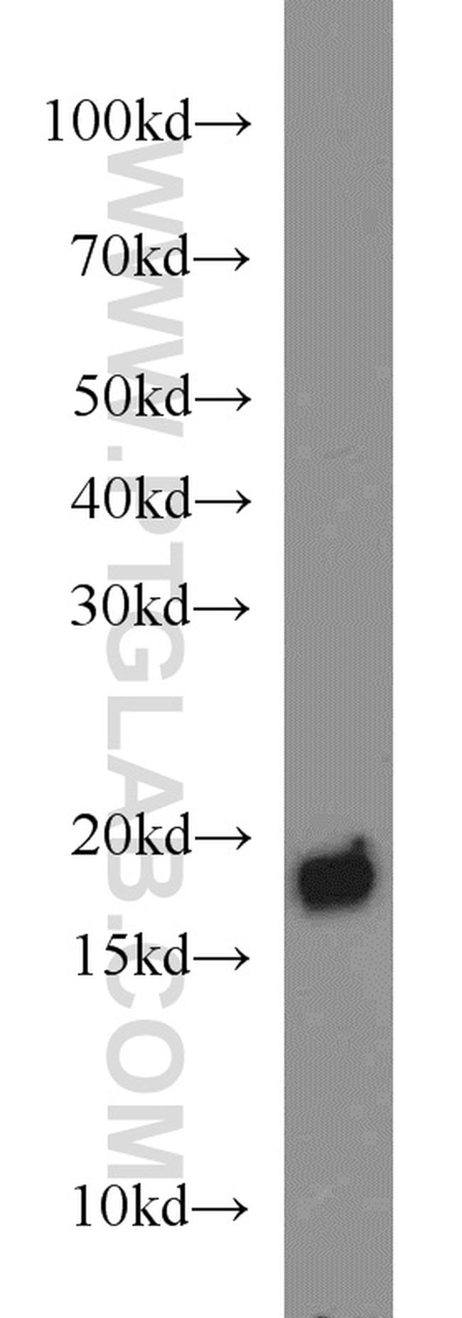 BUD31 Antibody in Western Blot (WB)