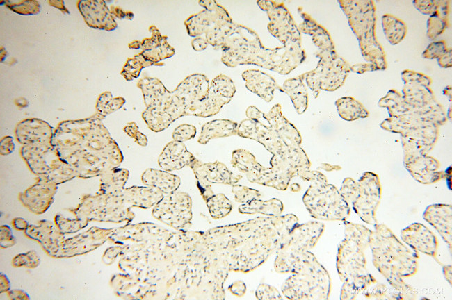 POPDC3 Antibody in Immunohistochemistry (Paraffin) (IHC (P))