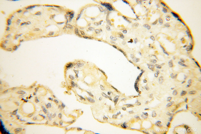 POPDC3 Antibody in Immunohistochemistry (Paraffin) (IHC (P))