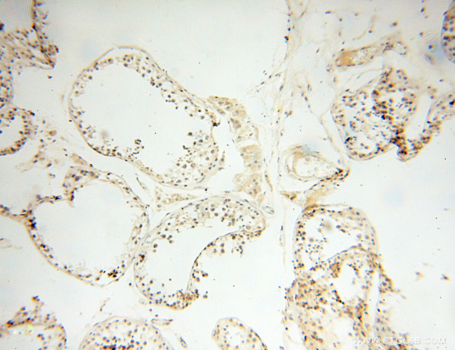 POPDC3 Antibody in Immunohistochemistry (Paraffin) (IHC (P))