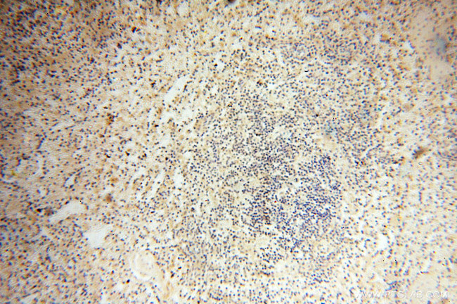 POPDC3 Antibody in Immunohistochemistry (Paraffin) (IHC (P))