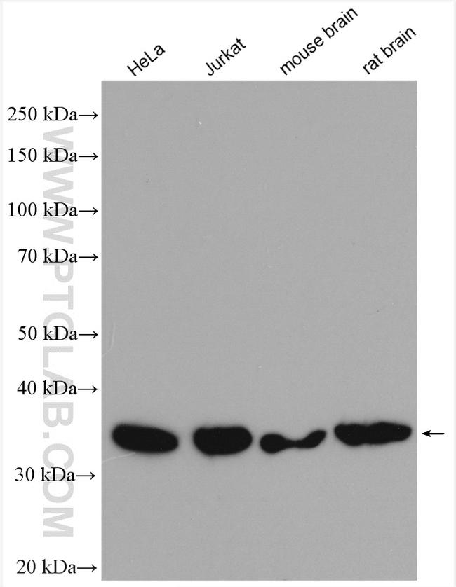 RABGGTB Antibody in Western Blot (WB)