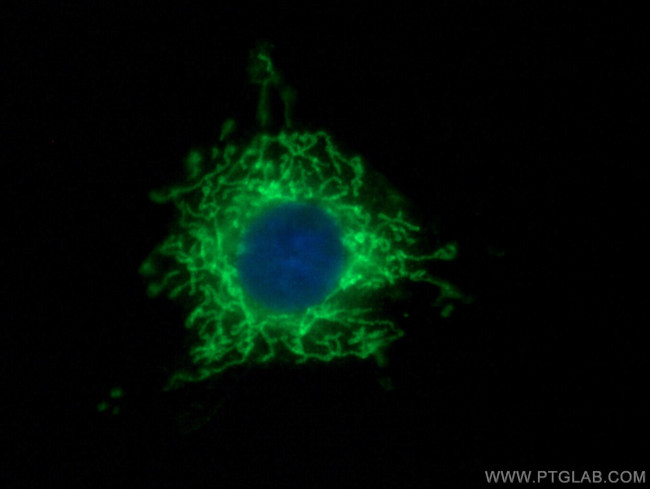 TOM20 Antibody in Immunocytochemistry (ICC/IF)