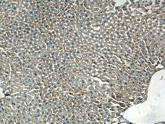 TOM20 Antibody in Immunohistochemistry (Paraffin) (IHC (P))