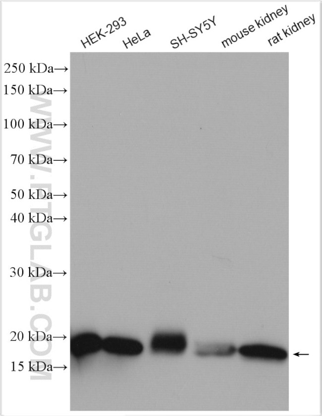 TOM20 Antibody in Western Blot (WB)