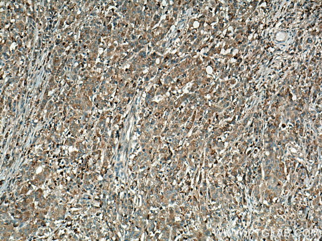 Annexin A3 Antibody in Immunohistochemistry (Paraffin) (IHC (P))