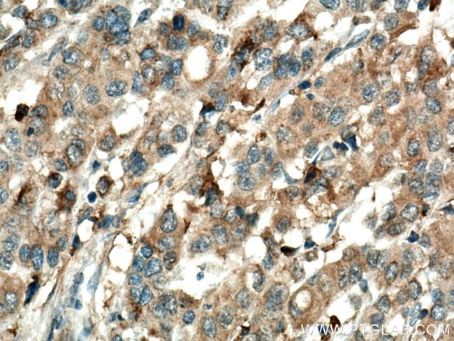 Annexin A3 Antibody in Immunohistochemistry (Paraffin) (IHC (P))