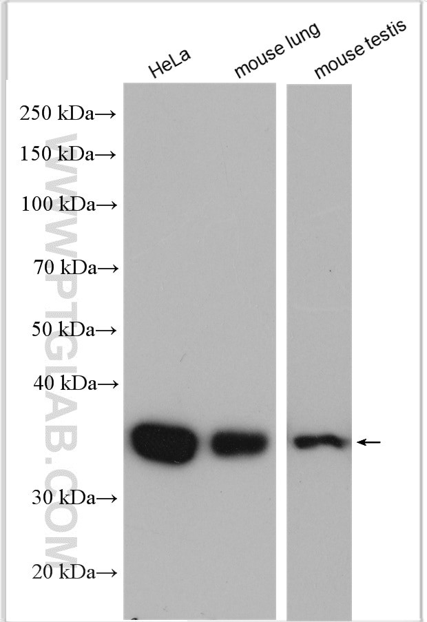 Annexin A3 Antibody in Western Blot (WB)