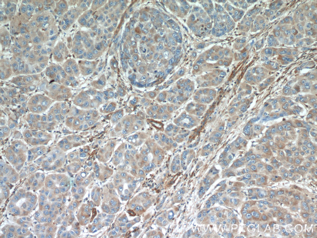 Annexin A3 Antibody in Immunohistochemistry (Paraffin) (IHC (P))