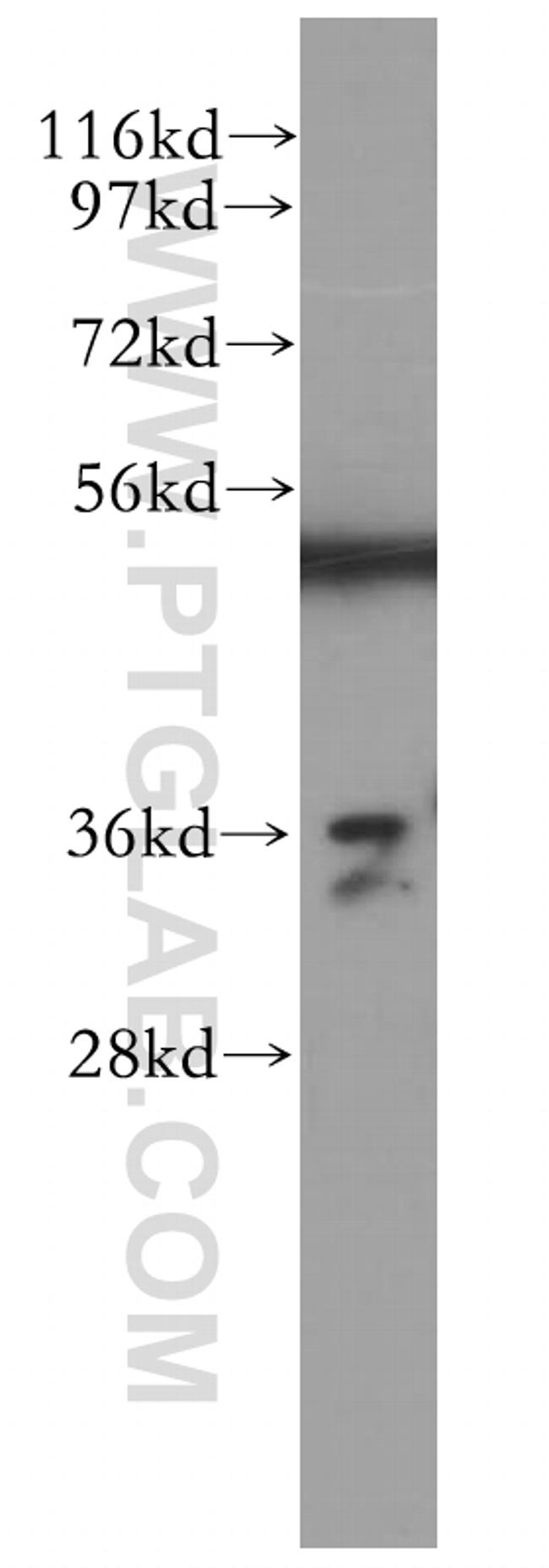 Annexin A3 Antibody in Western Blot (WB)