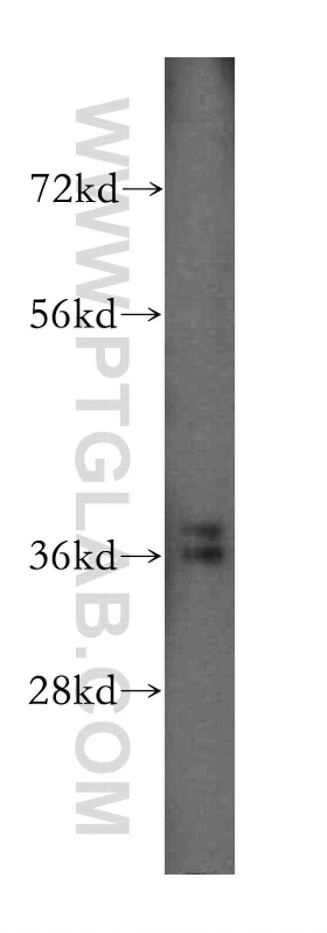 Annexin A3 Antibody in Western Blot (WB)